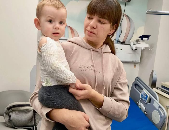 Перекинув на себе чайник з окропом: у Львові медики врятували немовля від важких опіків (фото)