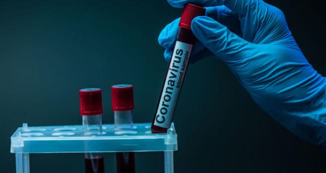В Україні за добу додалися майже 7 тисяч нових інфікувань COVID-19