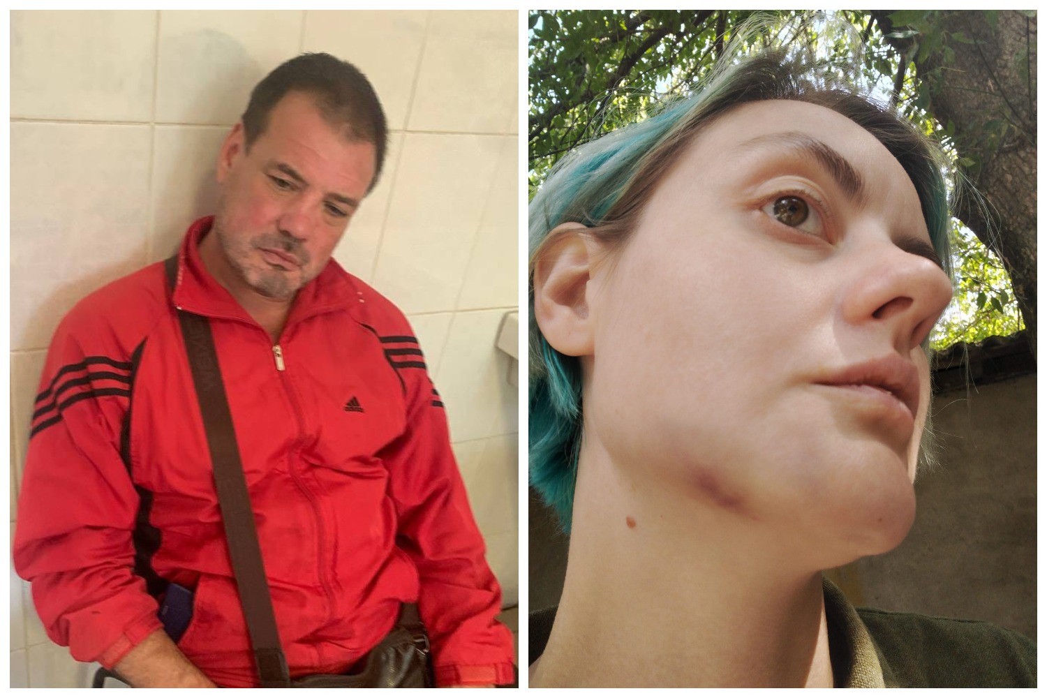 Працівника ТЦК, який побив дружину військового в Ужгороді, звільнили з лав ЗСУ