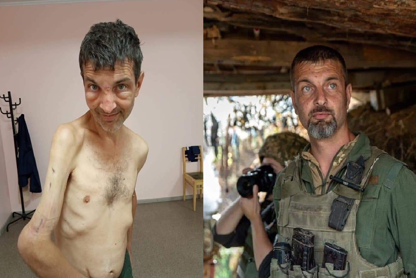 До і після полону: фото захисника Маріуполя, як ще один доказ злочинів Росії