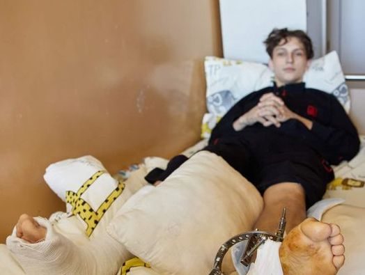 Історія 15-річного Андрія з Чернігівщини, який підірвався на міні ворога