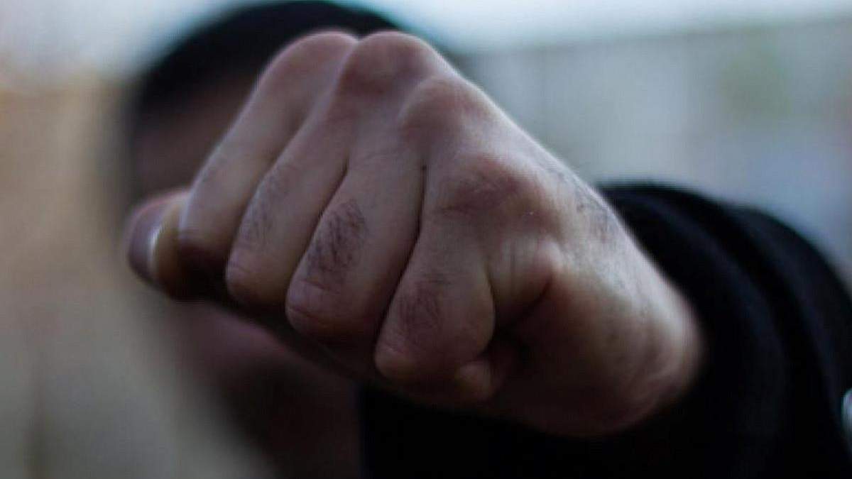 Били в голову і груди. В училищі на Львівщині жорстоко побили першокурсників