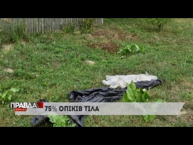 Чоловік облив себе бензином і згорів заживо