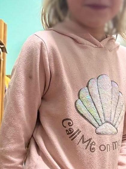 На Київщині вихователька дитбудинку катувала 9-річну дівчинку
