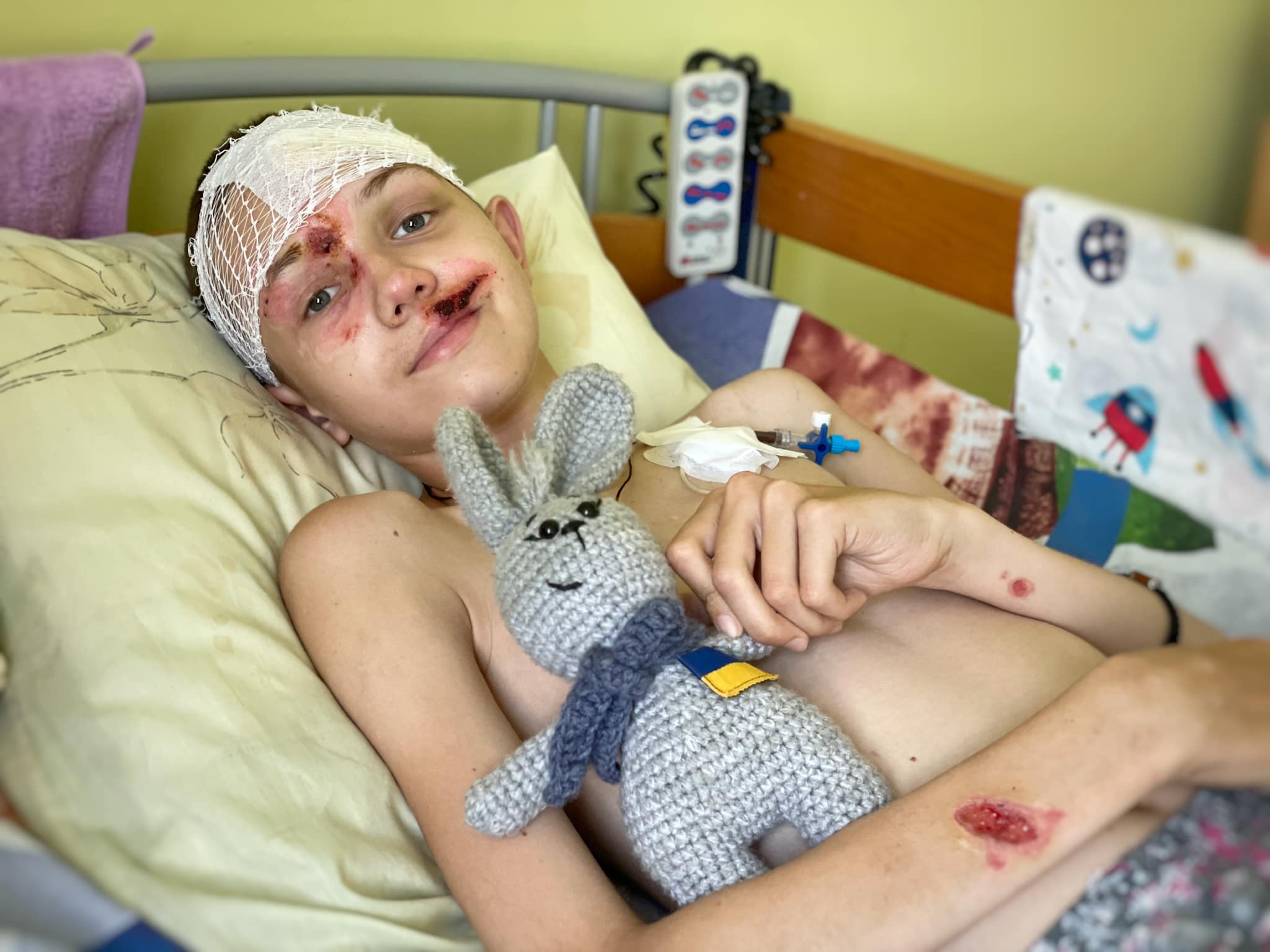 У дитячу кімнату прилетіла ракета. У Львові прооперували 12-річного Стаса з Донеччини