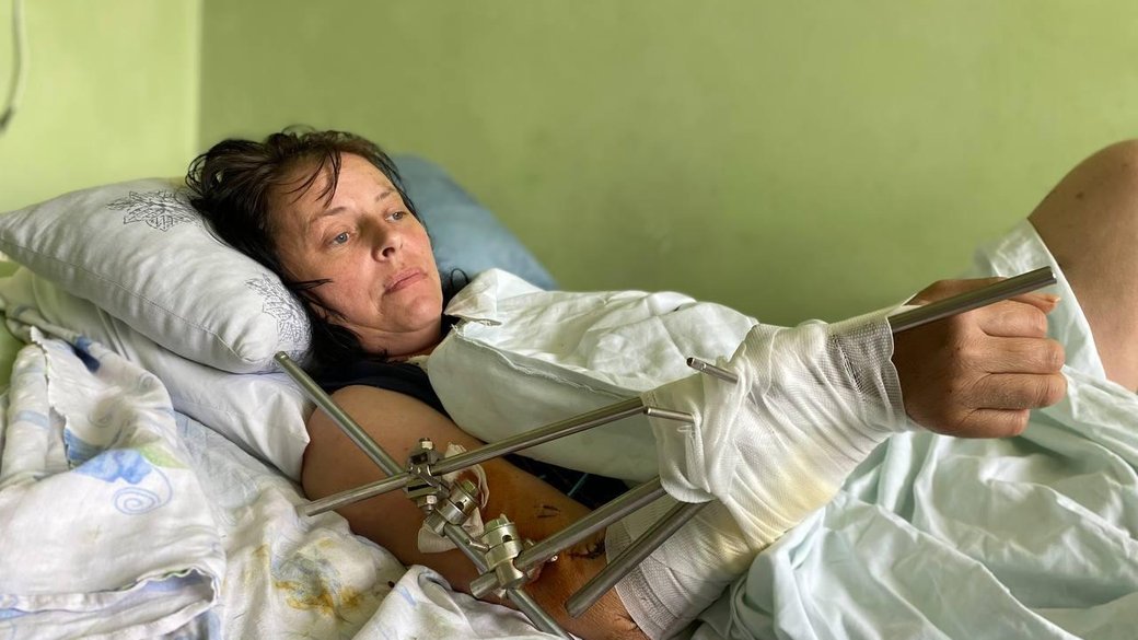 Львівські медики врятували ногу жінці з Бахмута