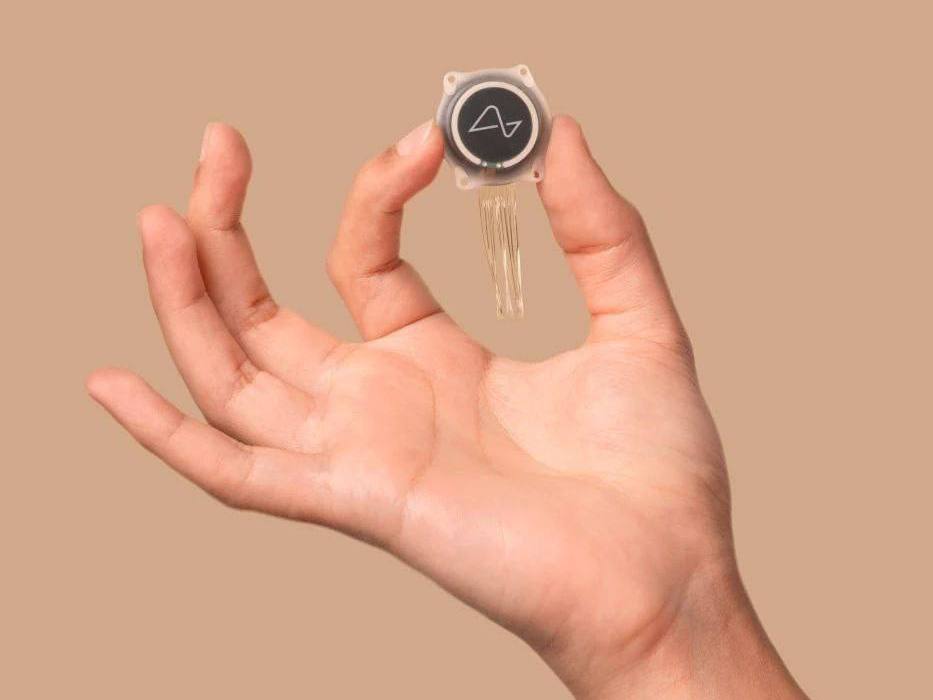 Компанія Neuralink Ілона Маска вперше вживила чип у мозок людини