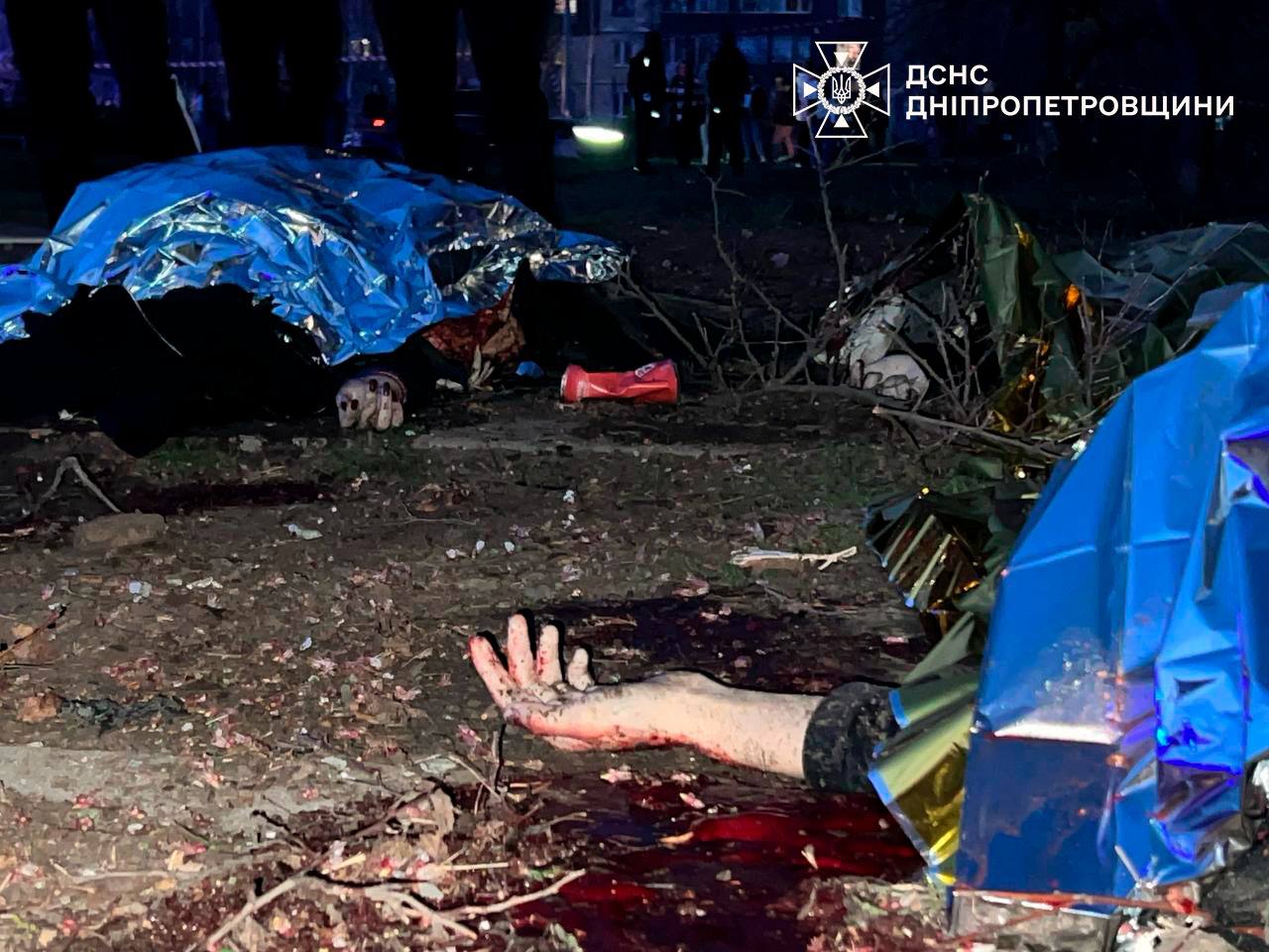 Ракетний удар по Кривому Розі: в якому стані постраждалі