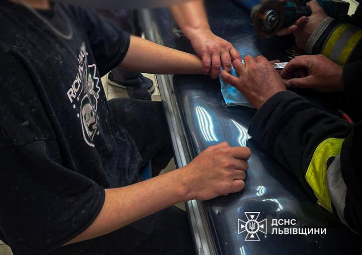 У Львові рятувальники допомогли хлопцю зняти металеве кільце з пальця