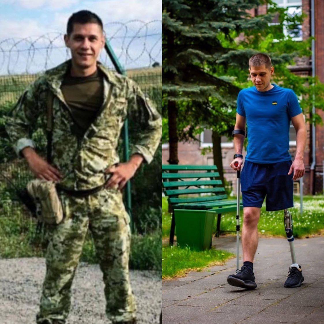 Втратив ногу, але не віру. Історія прикордонника, який серед перших зустрів ворога