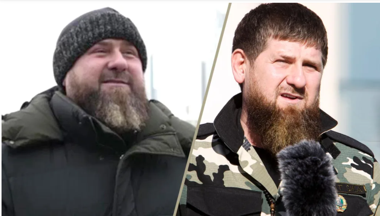 У чеченського диктатора Кадирова серйозні проблеми зі здоров'ям
