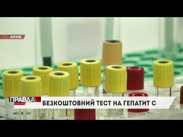У Львові можна буде безкоштовно зробити тест на гепатит