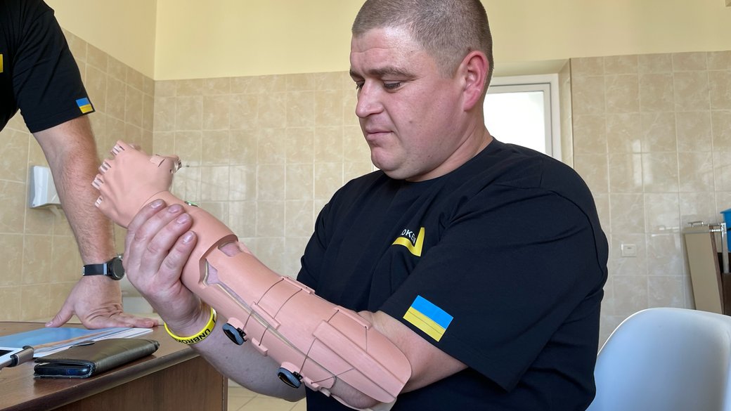 У Львові чоловік отримав протез руки, надрукований на ЗD-принтері