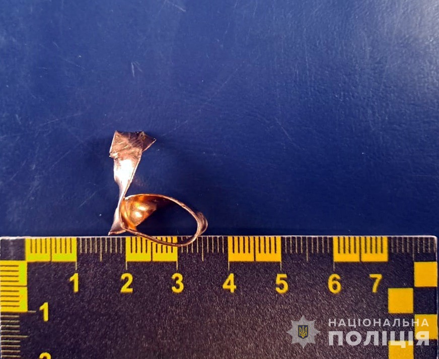 На Житомирщині працівник моргу плоскогубцями зрізав золоту обручку з руки загиблого захисника (фото)