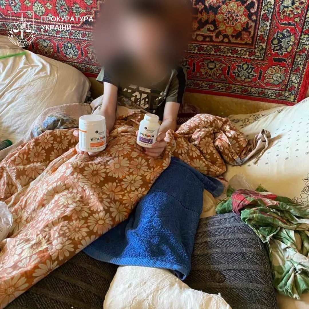 У Києві мати залишила сина зі зламаною ногою без їжі на два тижні: У якому стані дитина