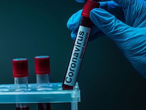 На території України виявили новий штам Covid-19 – МОЗ