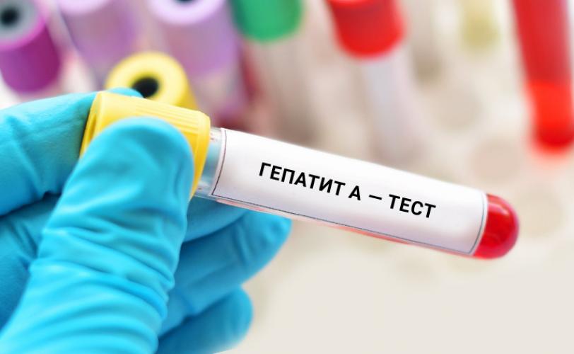 В Україні зафіксували спалах вірусного гепатиту. У лікарню потрапили десятки людей