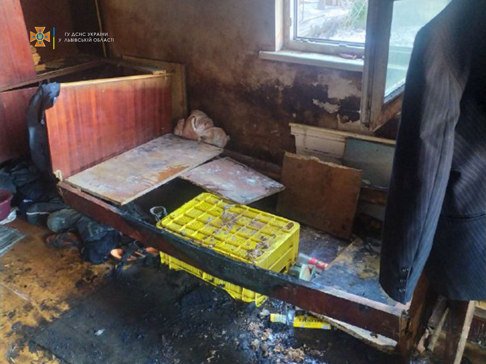 Обгорів у пожежі: львівські лікарі рятують чоловіка з важкими опіками