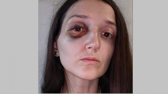 Побиття львів'янки у трамваї: поліція встановила причетних підлітків