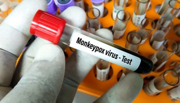 Мавпяча віспа вже в Україні: зафіксували першого хворого