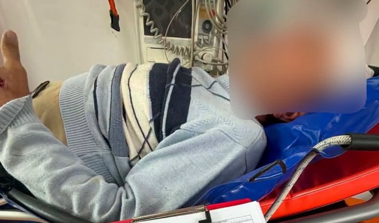Підступний удар у голову: на Берегівщині кінь травмував чоловіка