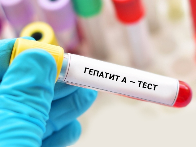 Майже три сотні хворих. На Вінниччині вирує гепатит А