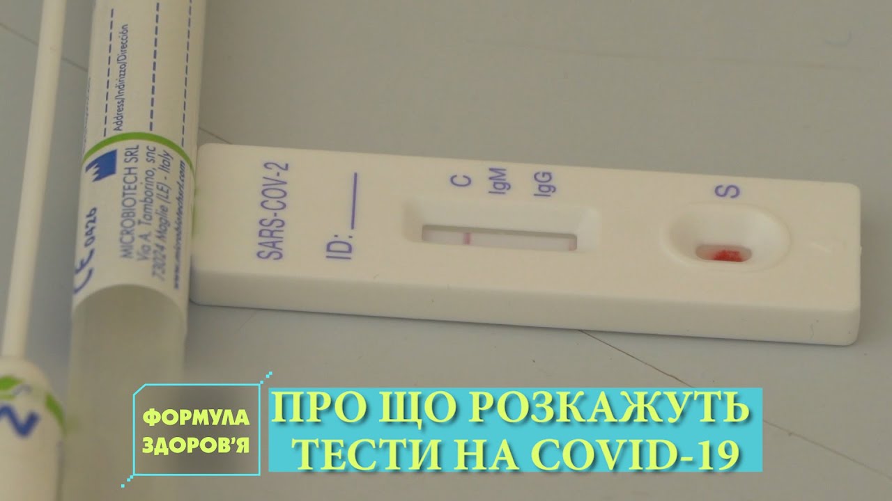 Експрес-аналіз. ПЛР-тест. Метод ІФА | Кому варто обстежитись