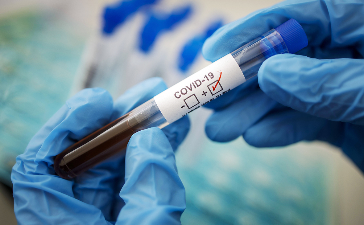COVID-19 не вщухає: Понад 24 тисячі нових випадків та 750 смертей