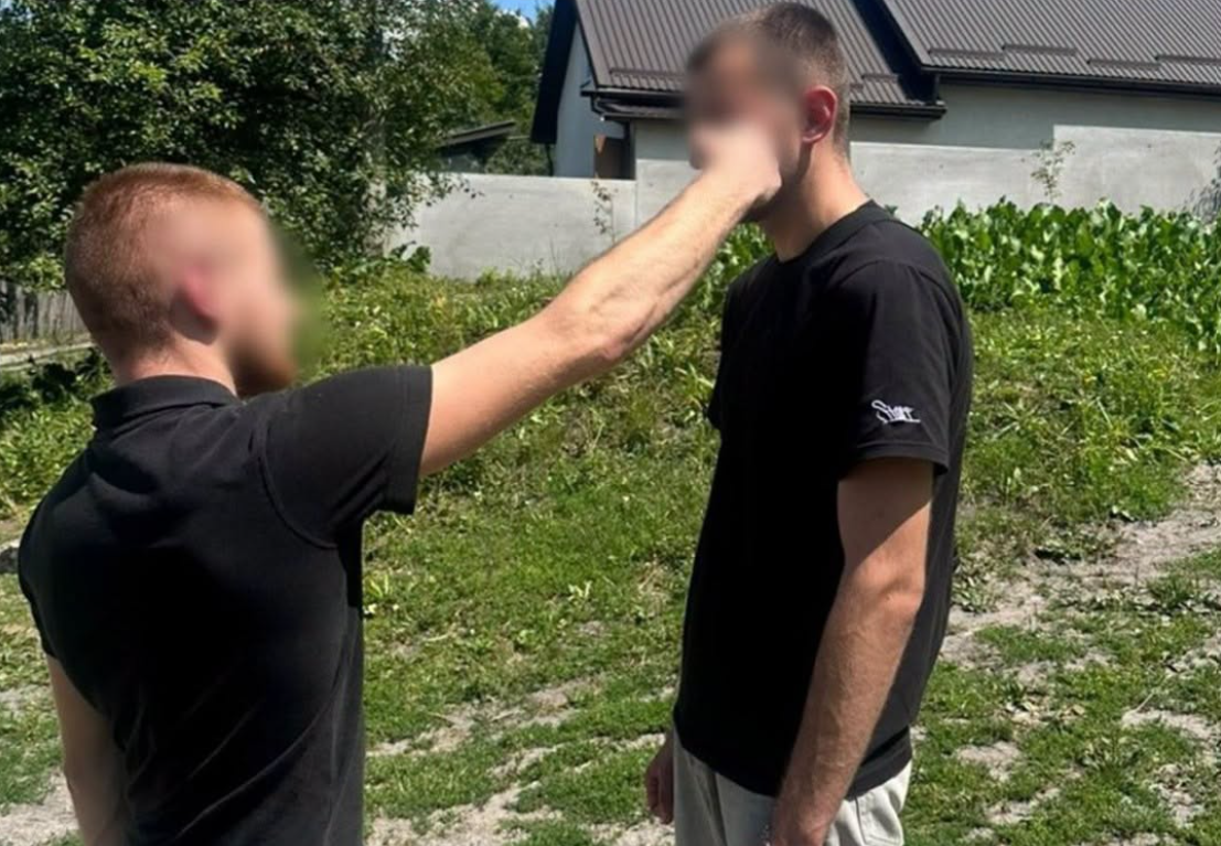 Кулаками по обличчю: на Львівщині сварка між чоловіками закінчилася тяжкою травмою
