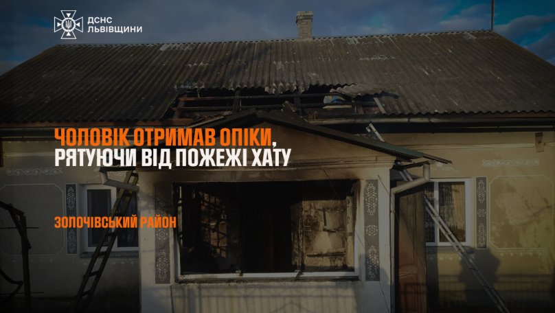 Отримав опіки руки: на Львівщині 25-річний чоловік рятував будинок від пожежі