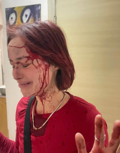 В Одесі чоловік у військовій формі побив дівчину: в ТЦК почали службову перевірку