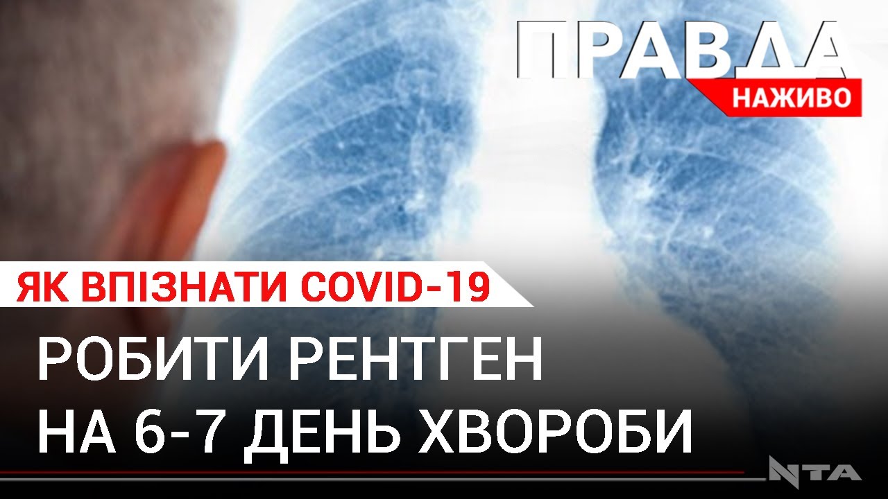Коронавірус та ГРВІ: чи варто ізольовуватися при перших симптомах?