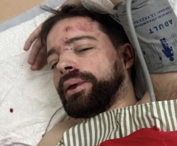 У Львівському ТЦК прокоментували інформацію про "побитого працівника університету Франка"