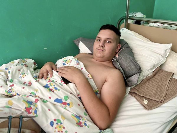 У ДТП відірвало частину кістки: львівські медики врятували 15-річного мотоцикліста