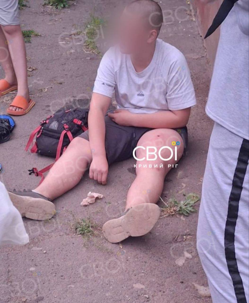 Вистрілив дитині в ногу на дитячому майданчику: Подробиці інциденту у Кривому Розі (ФОТО, ВІДЕО)