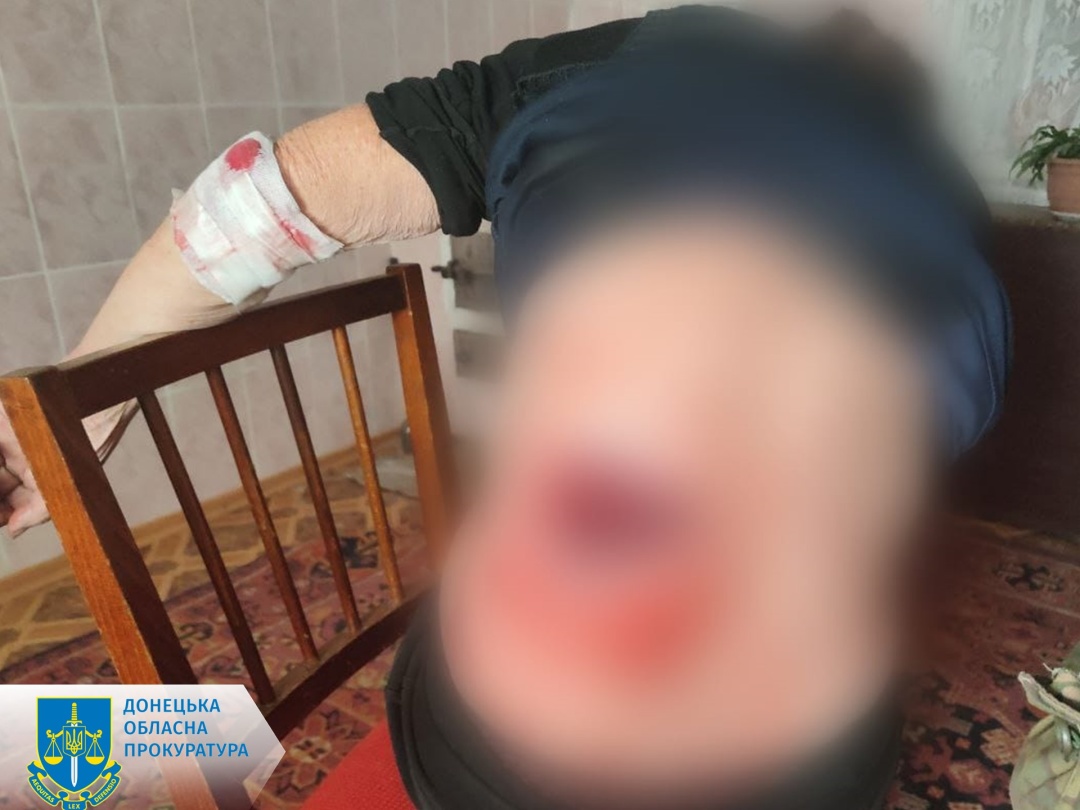Окупанти влучили по житловій забудові у Покровському районі