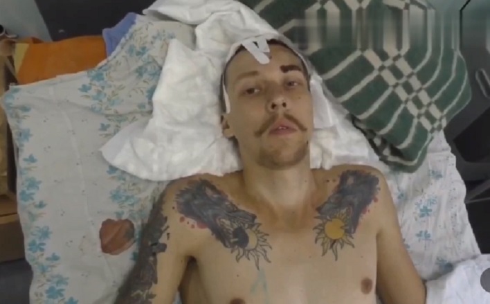 Російські пропагандисти виклали відео з пораненими в Оленівці українськими полоненими