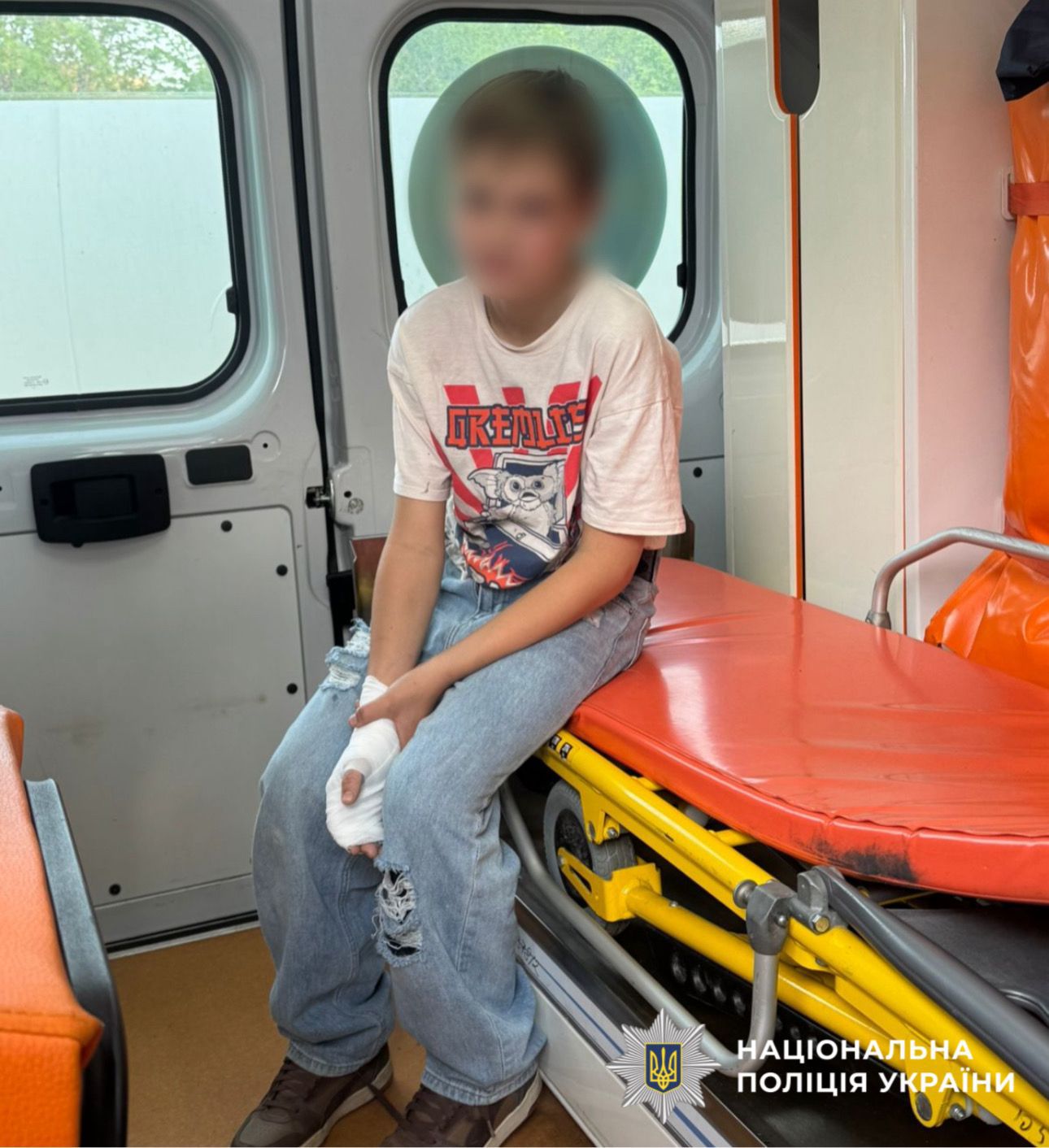 На Київщині 13-річний хлопець отримав опіки від батареї «шахеда»