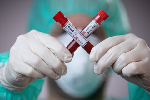 В Україні менше 8 тисяч захворювань COVID-19 та 400 смертей за добу