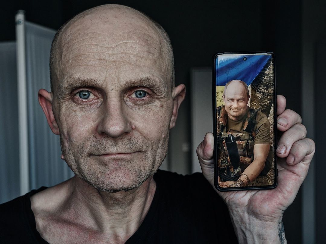 Їх не зламати: фотографи показали військових, які втратили у полоні РФ по 40-50 кг ваги