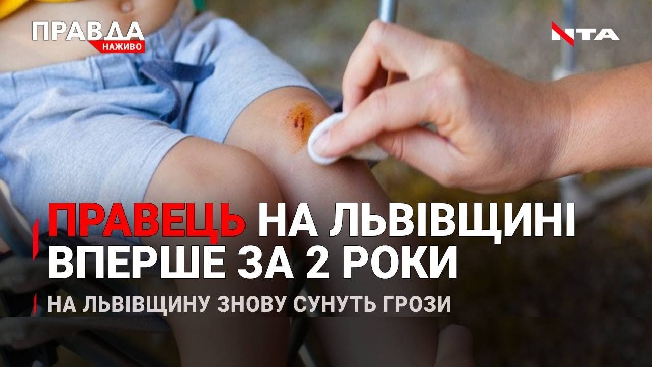Коли чекати на грозу? | Небезпечна недуга на Львівщині | Заміна Авакову | НОВИНИ за 16 липня