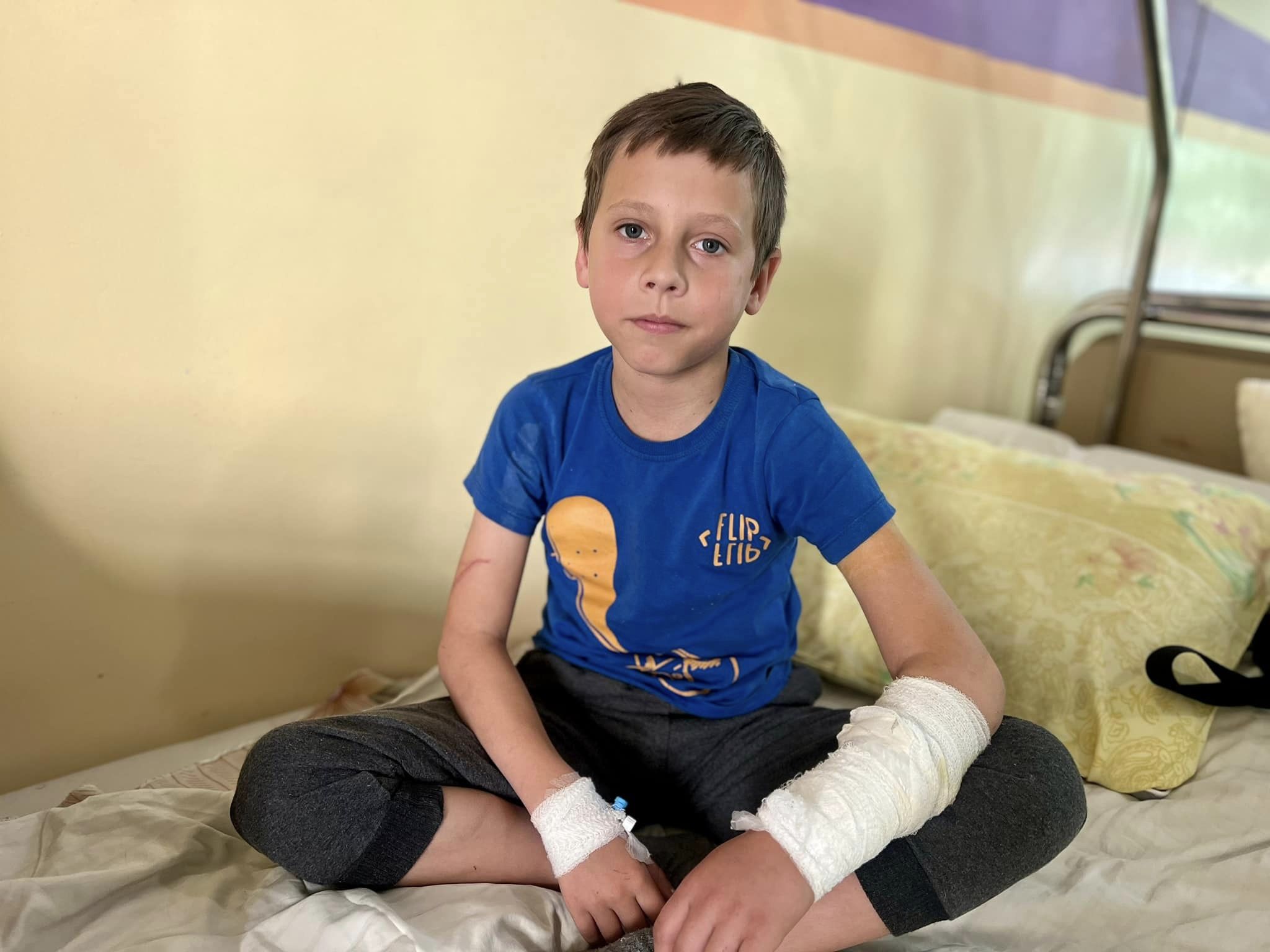 Проткнув руку металевою огорожею: у Львові прооперували 10-річного хлопчика