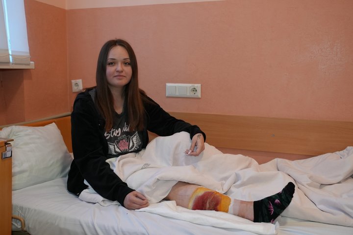 Вибух в Івано-Франківську: поранена жінка розповіла, як її рятували (відео)
