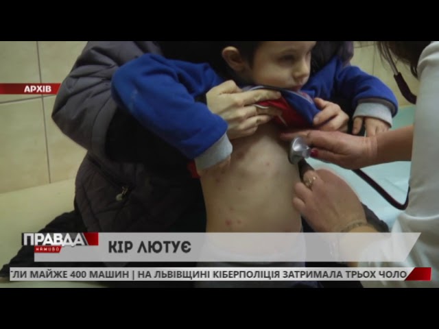 На Львівщині невпинно росте кількість хворих на кір