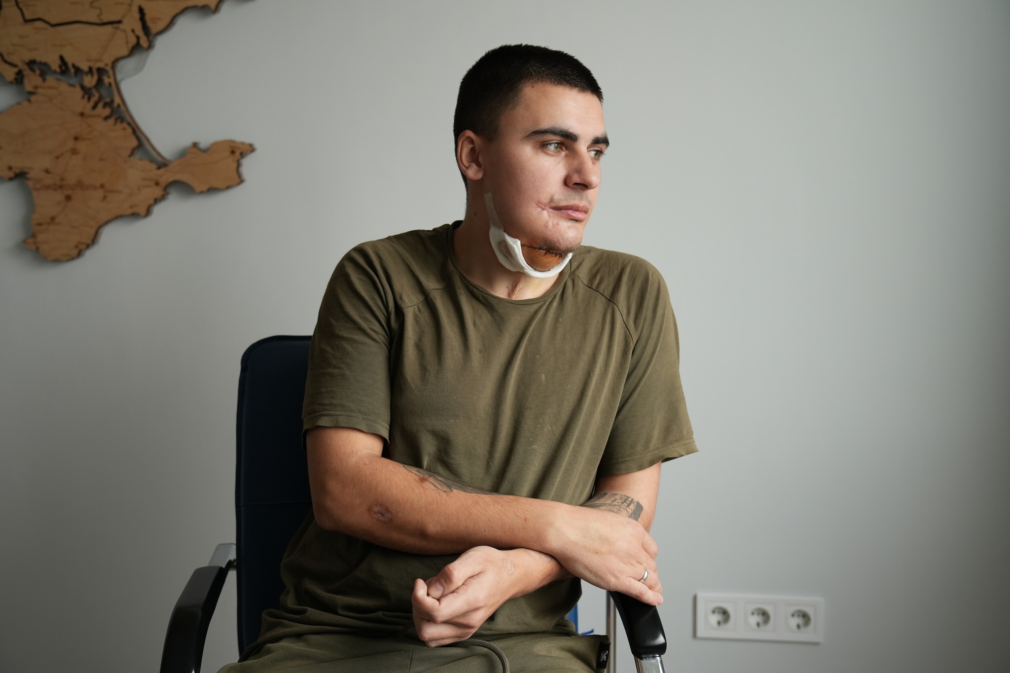 Львівські хірурги сформували 25-річному воїну щелепу з кістки на нозі