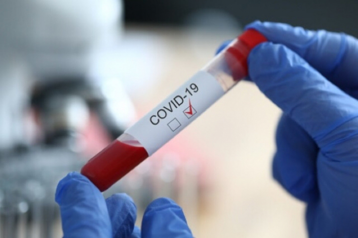 COVID-19 в Україні: оновлена статистика станом на 13 лютого
