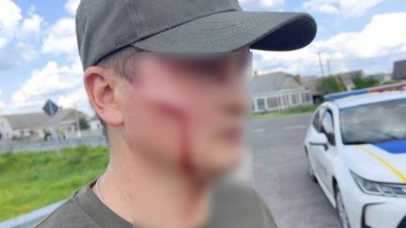 На Волині чоловік побив військовослужбовців ТЦК лопатою та втік (відео)