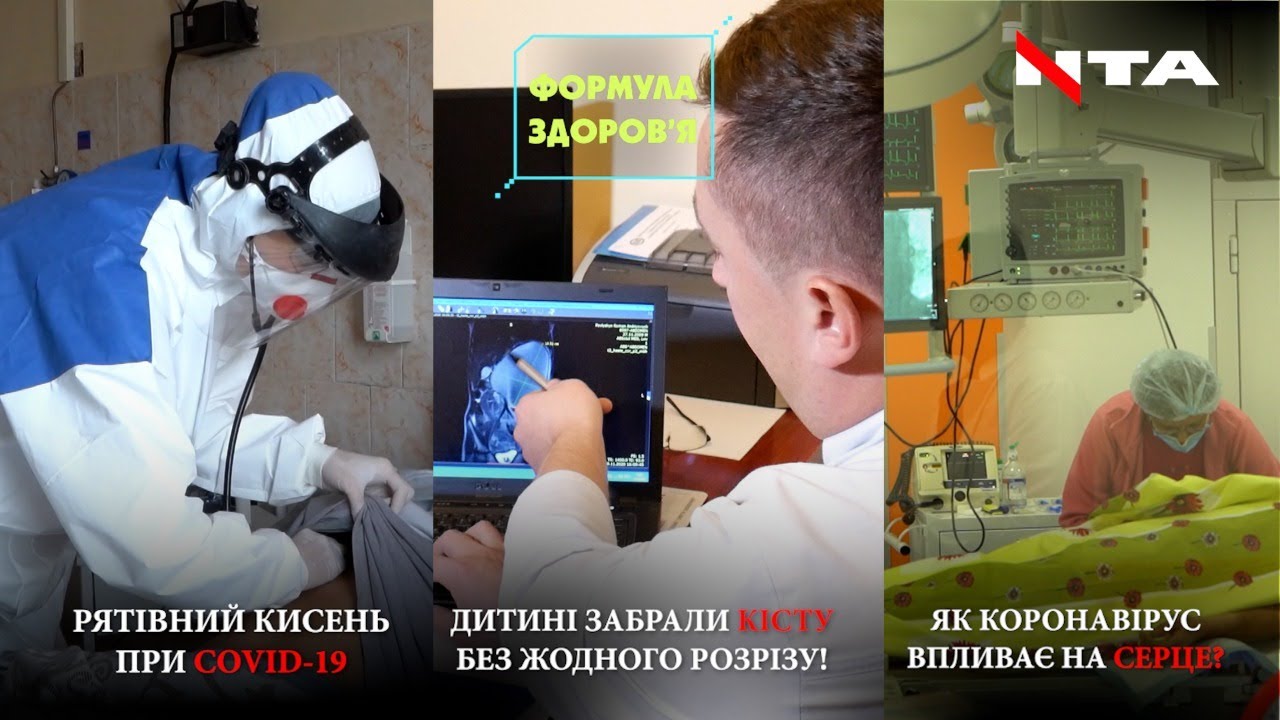 Як рятують пацієнтів з Covid-19? | Унікальний випадок порятунку дитини